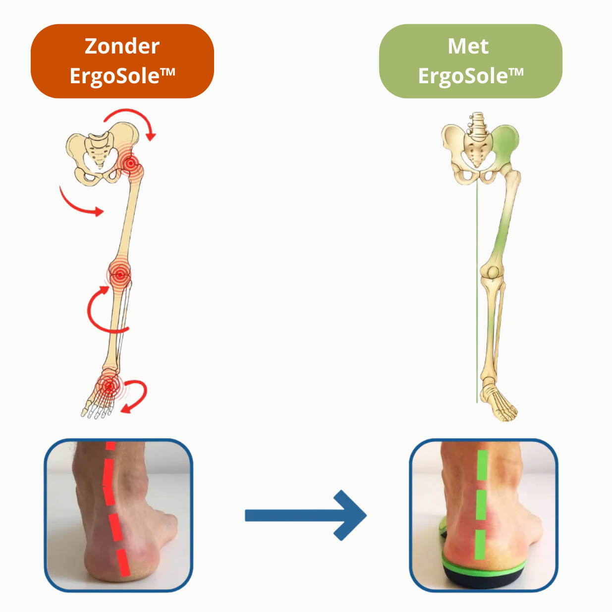 ErgoSole™ – Orthopedische Inlegzool met Boogondersteuning & Schokabsorptie