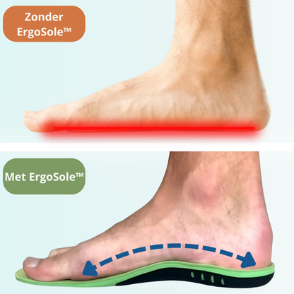 ErgoSole™ – Orthopedische Inlegzool met Boogondersteuning & Schokabsorptie